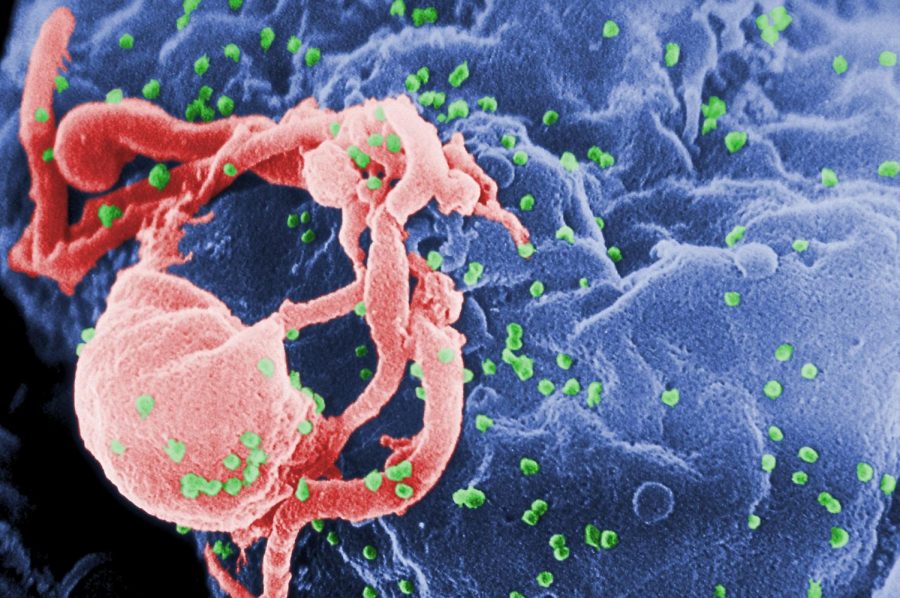 HIV+ATTACKS%3A+HIV+budding+%28in+green%29+from+a+lymphocyte.+The+image+has+been+colorized+to+emphasize+important+features.+