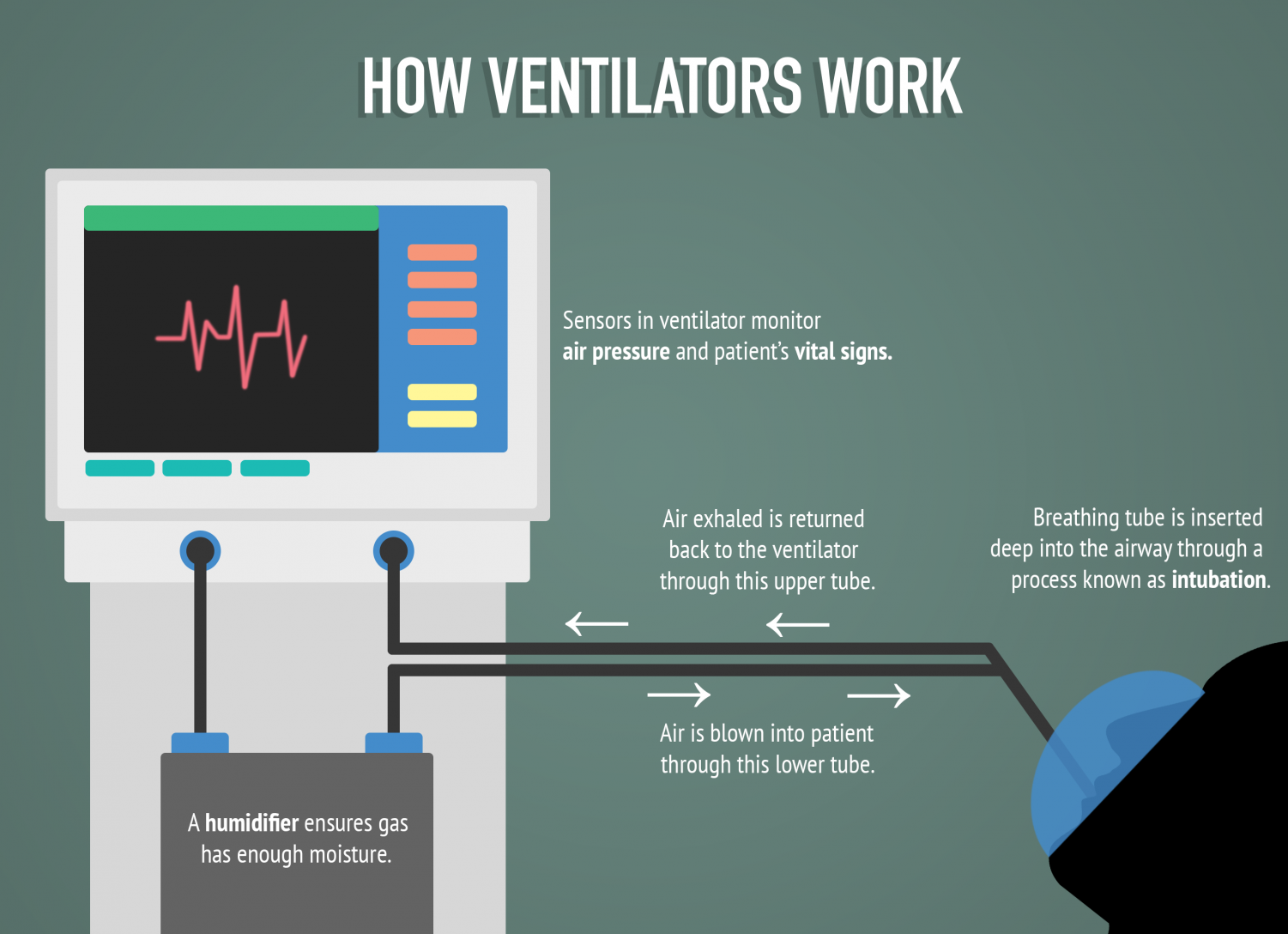 INFOGRAPHIC: Helping a person breathe – The Mirror